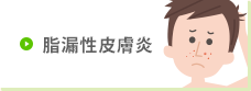 脂漏性皮膚炎
