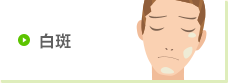白斑